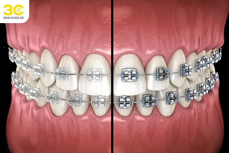 Kiến thức Nha khoa - Nha Khoa 3C