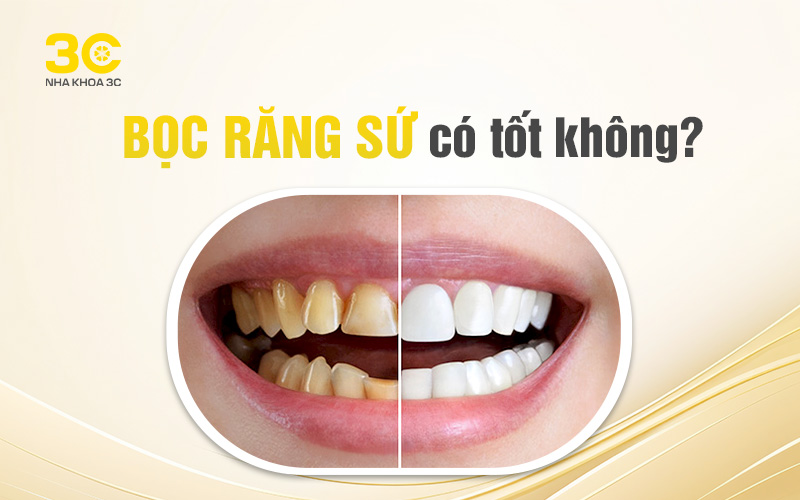 Kiến thức Nha khoa - Nha Khoa 3C