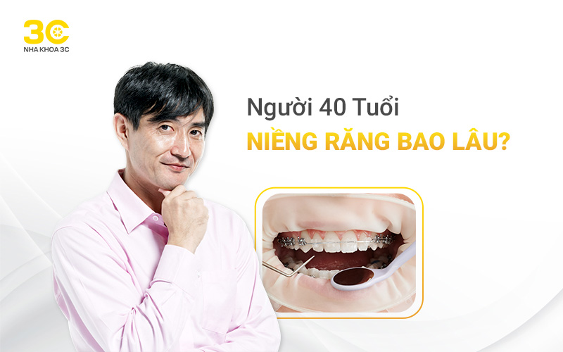 Kiến thức niềng răng - Nha Khoa 3C