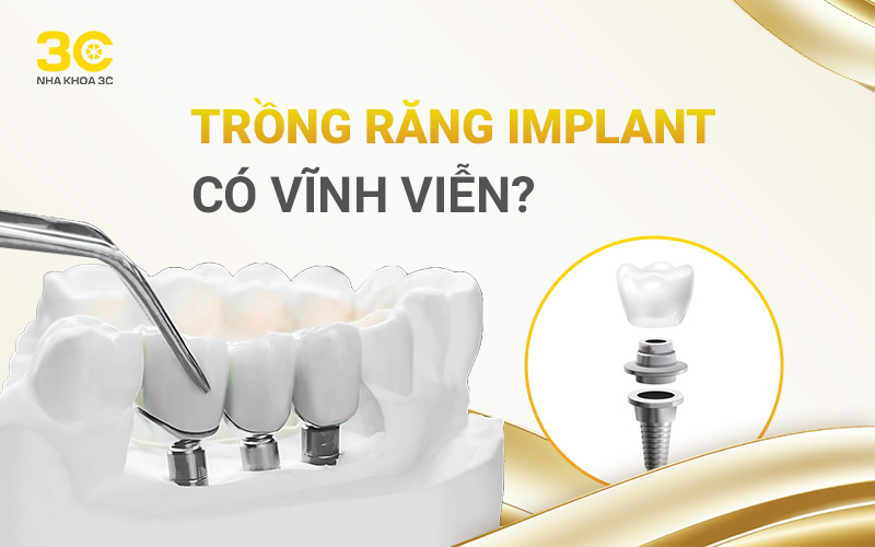 Kiến thức tổng quát - Nha Khoa 3C