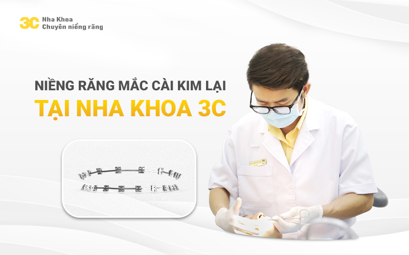 Niềng răng mắc cài kim loại tại Nha Khoa 3C