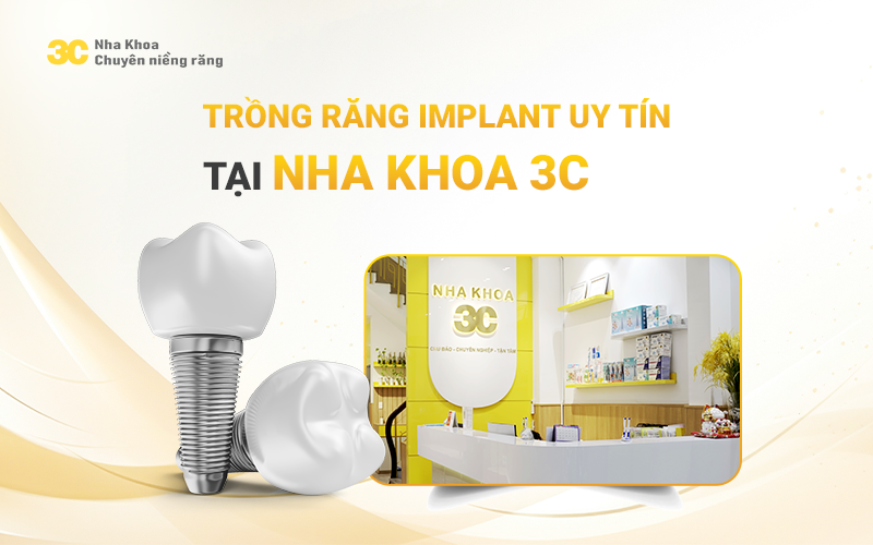 Trồng răng implant tốt tphcm