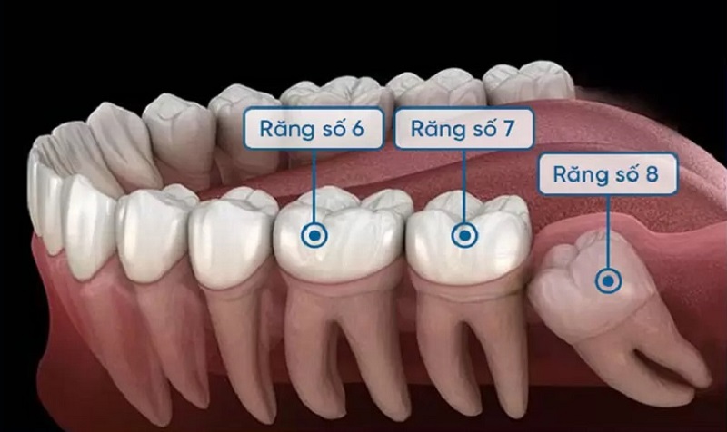 Răng cấm có thay không?