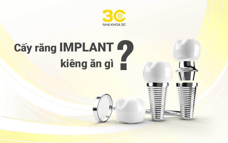Cấy răng Implant kiêng gì?