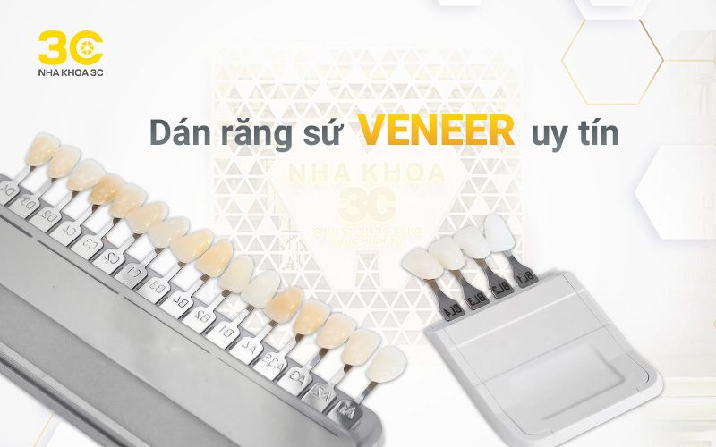 Dán răng sứ veneer uy tín