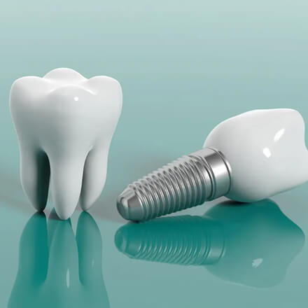 Orthodontics - Nha Khoa 3C