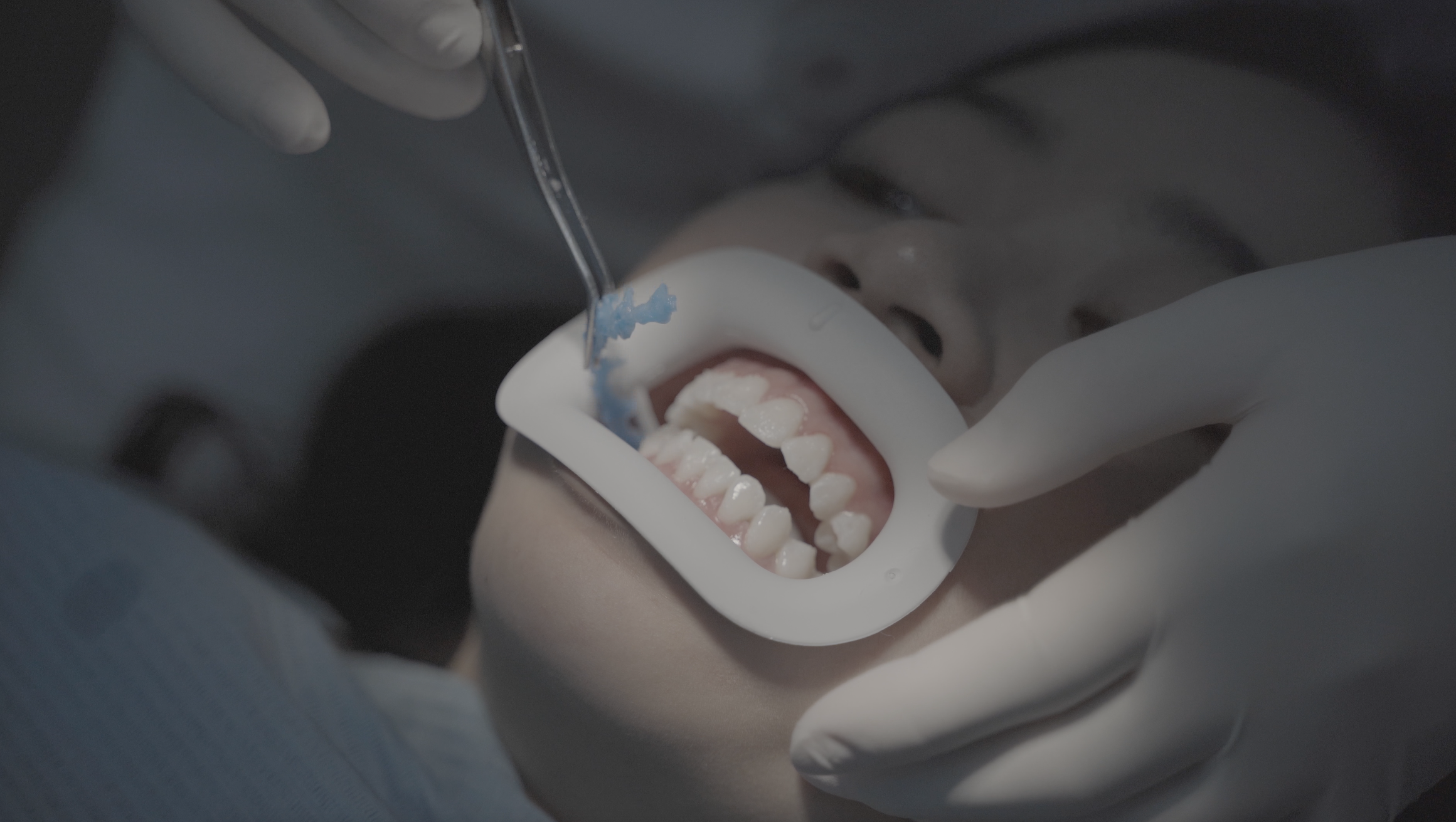 Teeth Whitening - Nha Khoa 3C