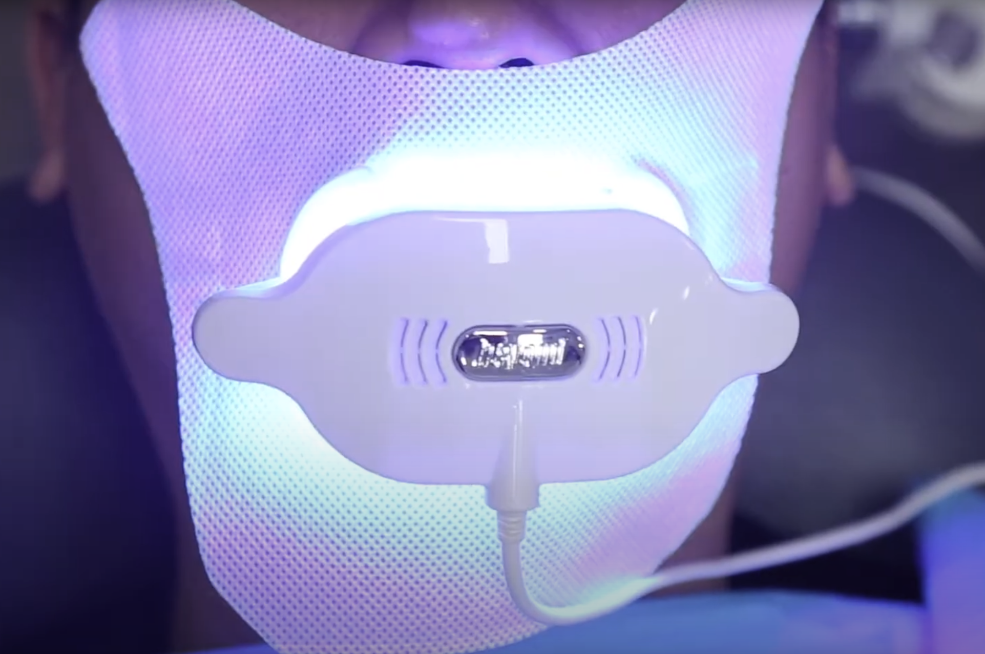 Teeth Whitening - Nha Khoa 3C