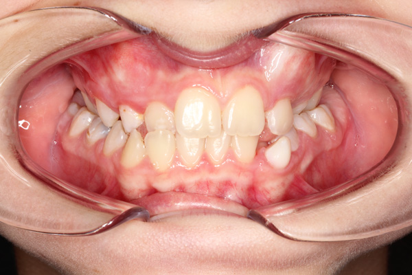 Orthodontics - Nha Khoa 3C