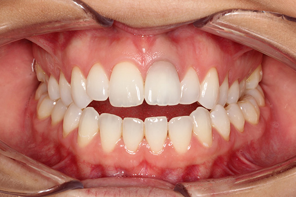 Orthodontics - Nha Khoa 3C