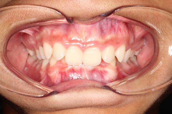 Orthodontics - Nha Khoa 3C