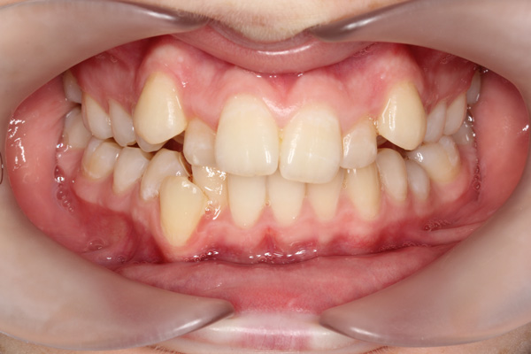 Orthodontics - Nha Khoa 3C