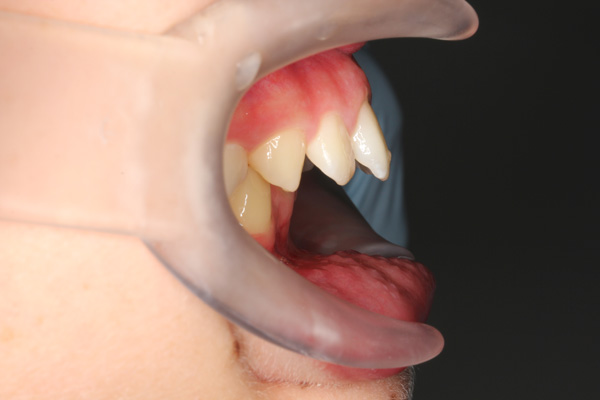 Orthodontics - Nha Khoa 3C