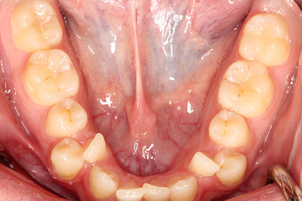 Orthodontics - Nha Khoa 3C