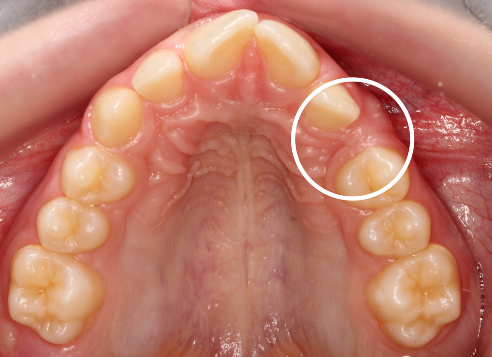 Orthodontics - Nha Khoa 3C