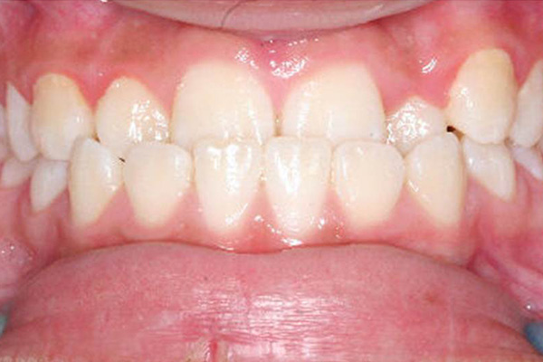 Orthodontics - Nha Khoa 3C