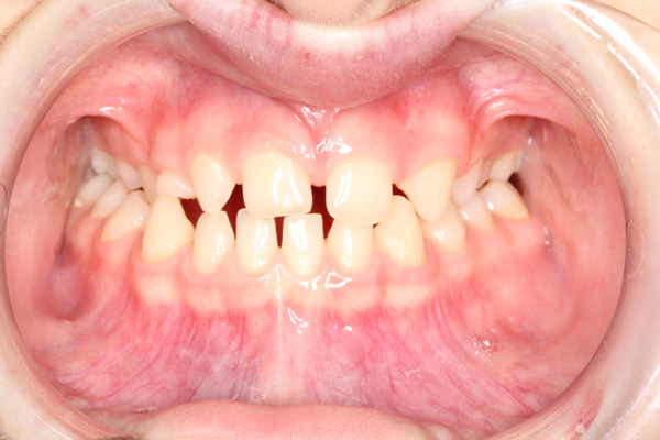 Orthodontics - Nha Khoa 3C