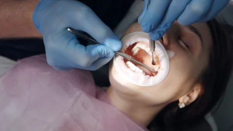 Dental Implant - Nha Khoa 3C