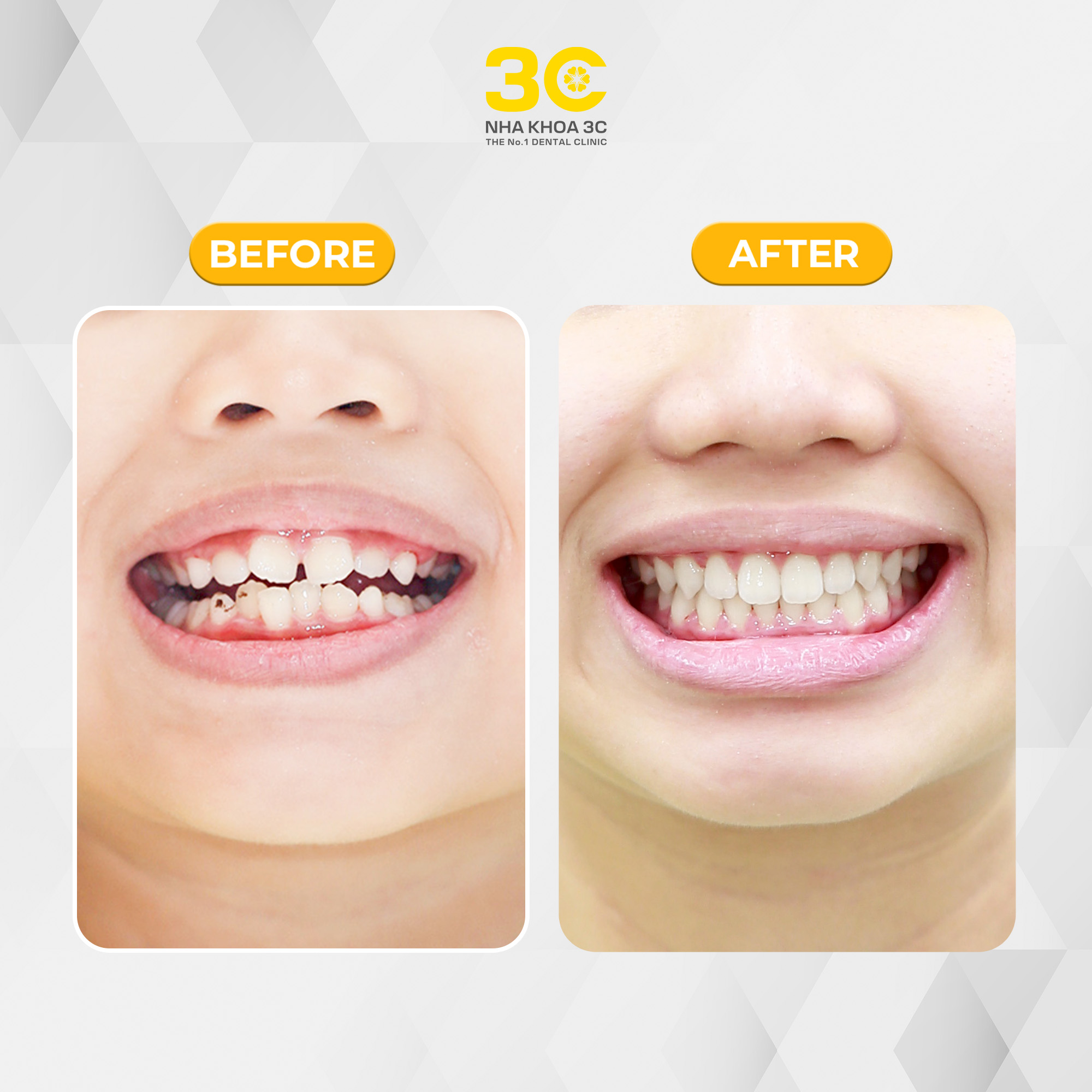 NHA KHOA 3C - DỊCH VỤ NHA KHOA UY TÍN TẠI TPHCM