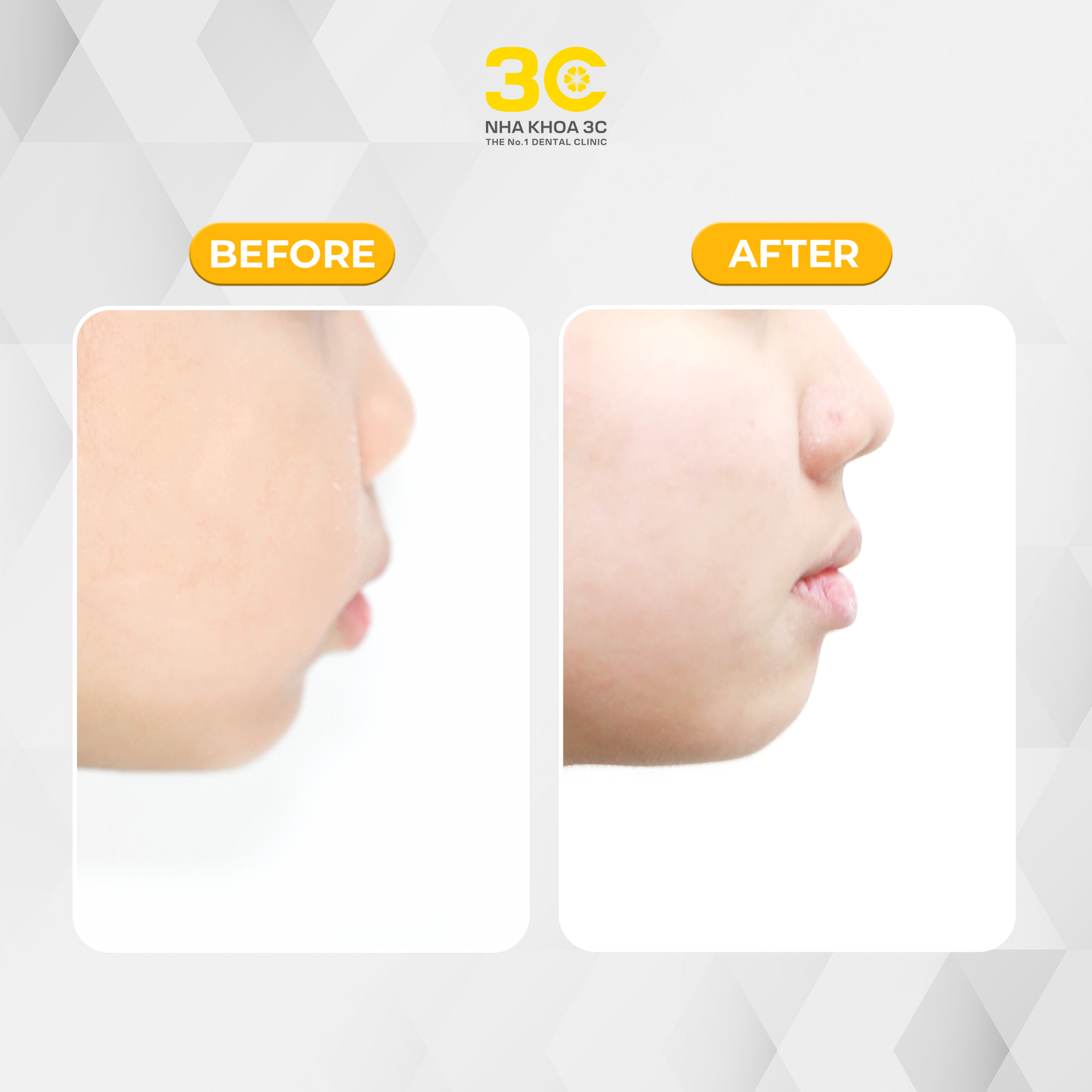 NHA KHOA 3C - DỊCH VỤ NHA KHOA UY TÍN TẠI TPHCM