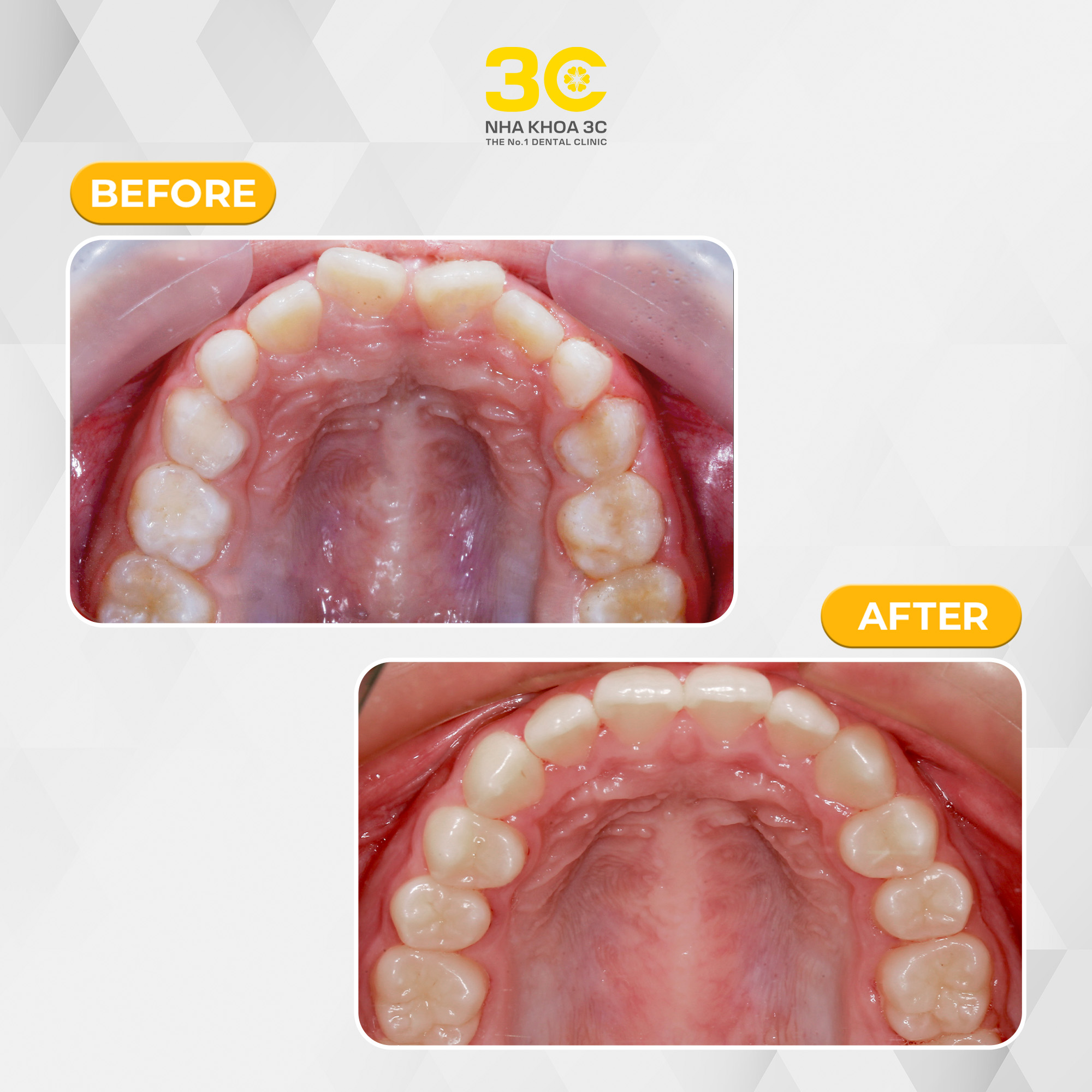 NHA KHOA 3C - DỊCH VỤ NHA KHOA UY TÍN TẠI TPHCM