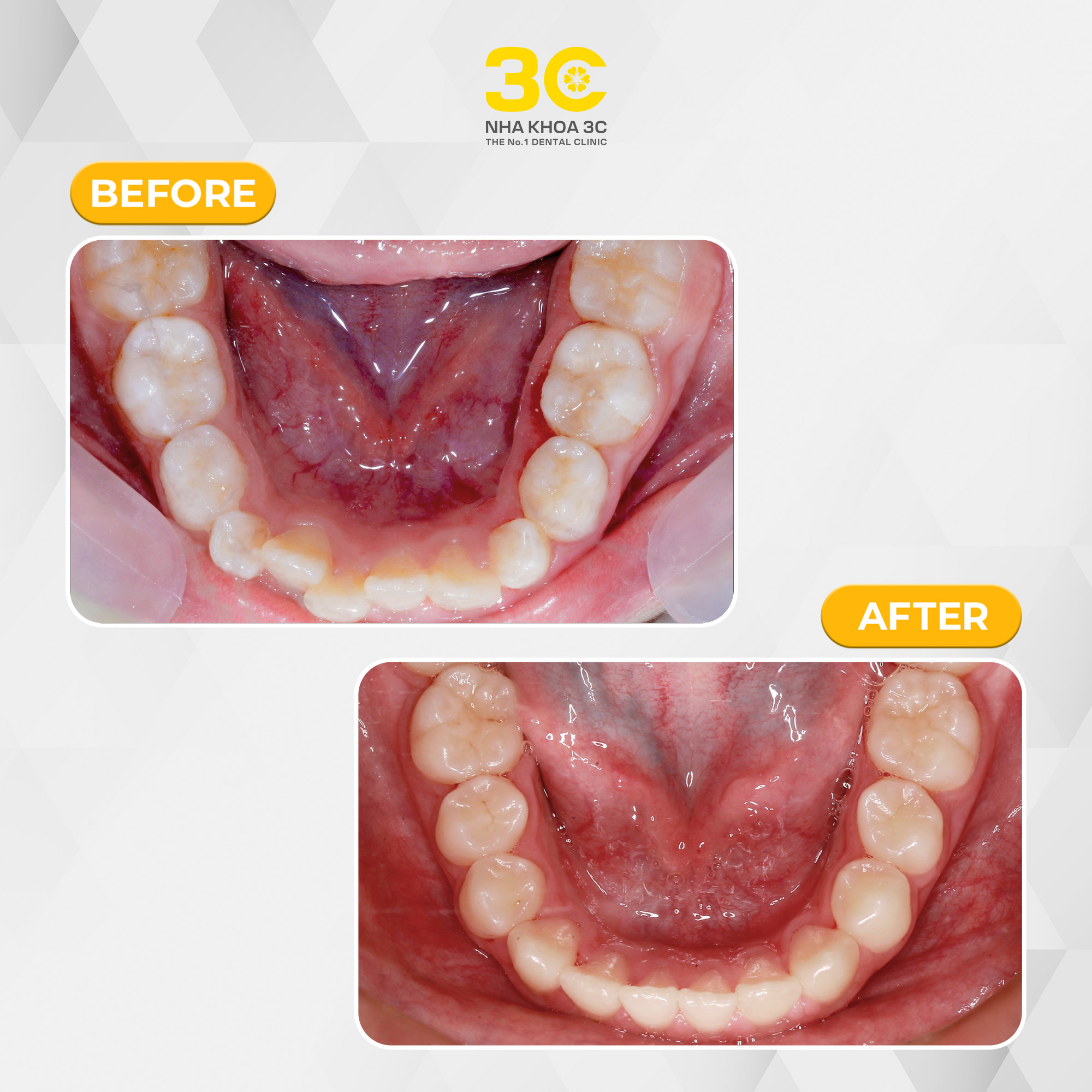 NHA KHOA 3C - DỊCH VỤ NHA KHOA UY TÍN TẠI TPHCM