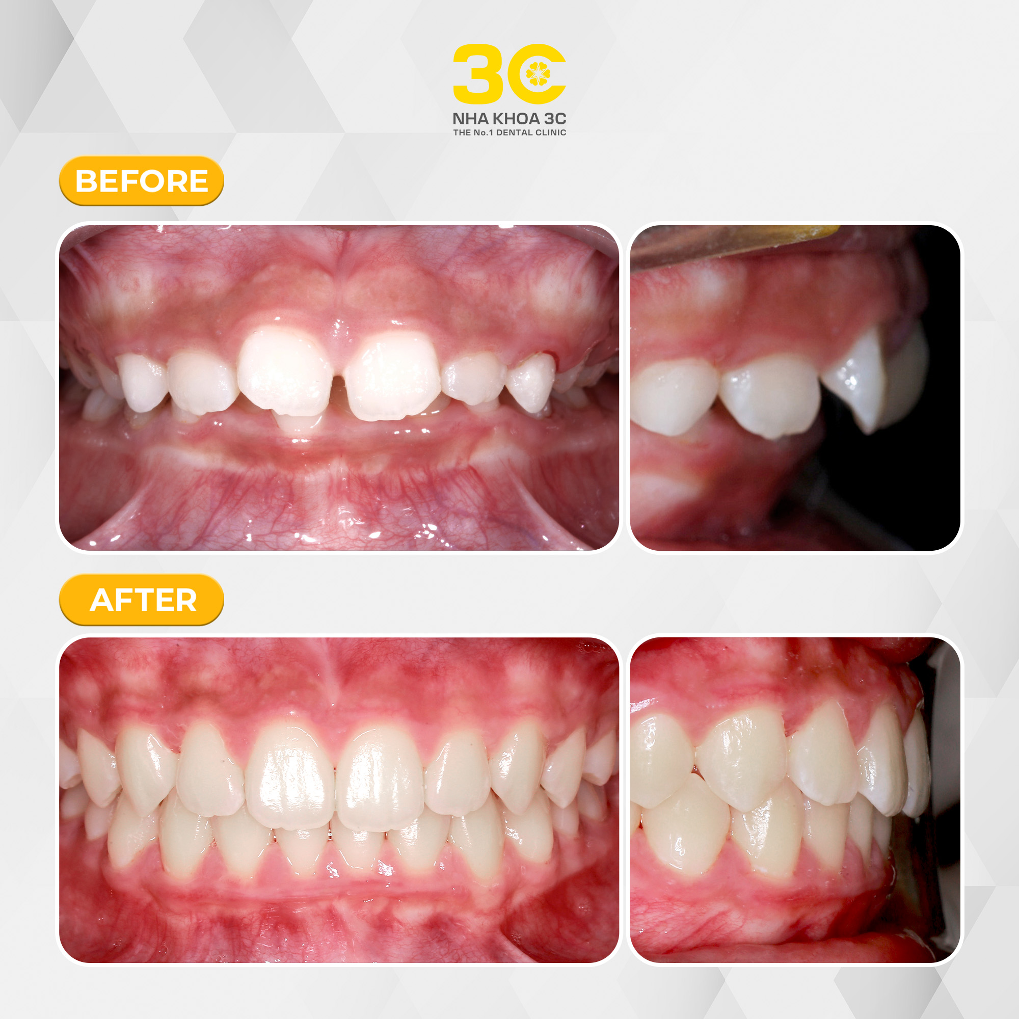 NHA KHOA 3C - DỊCH VỤ NHA KHOA UY TÍN TẠI TPHCM