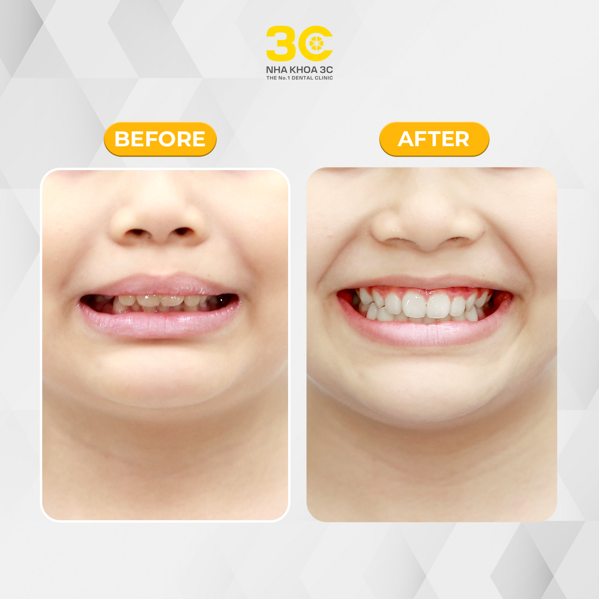 NHA KHOA 3C - DỊCH VỤ NHA KHOA UY TÍN TẠI TPHCM