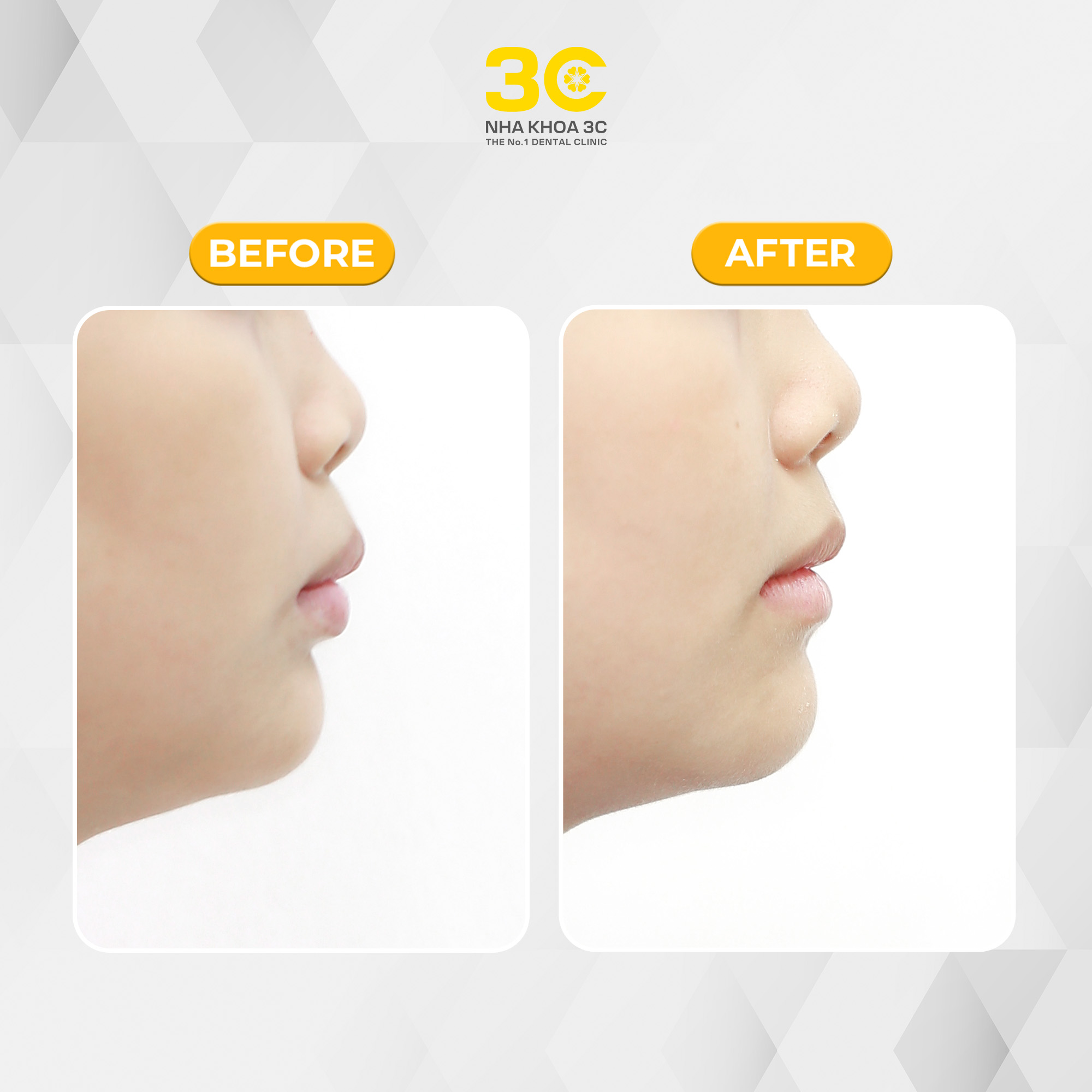 NHA KHOA 3C - DỊCH VỤ NHA KHOA UY TÍN TẠI TPHCM