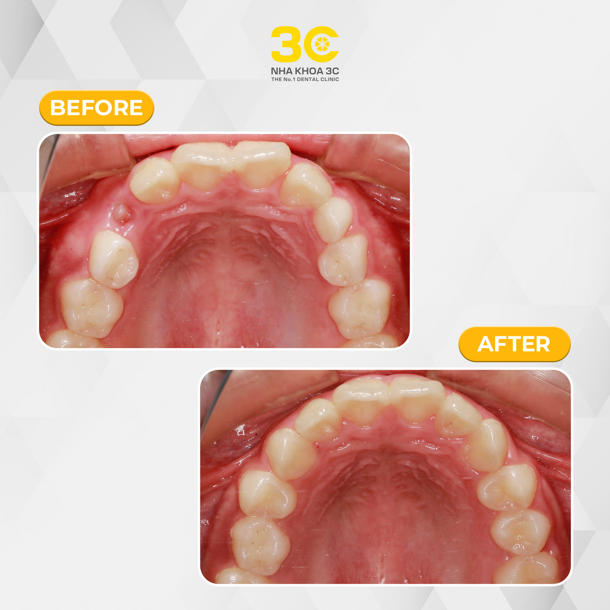 NHA KHOA 3C - DỊCH VỤ NHA KHOA UY TÍN TẠI TPHCM