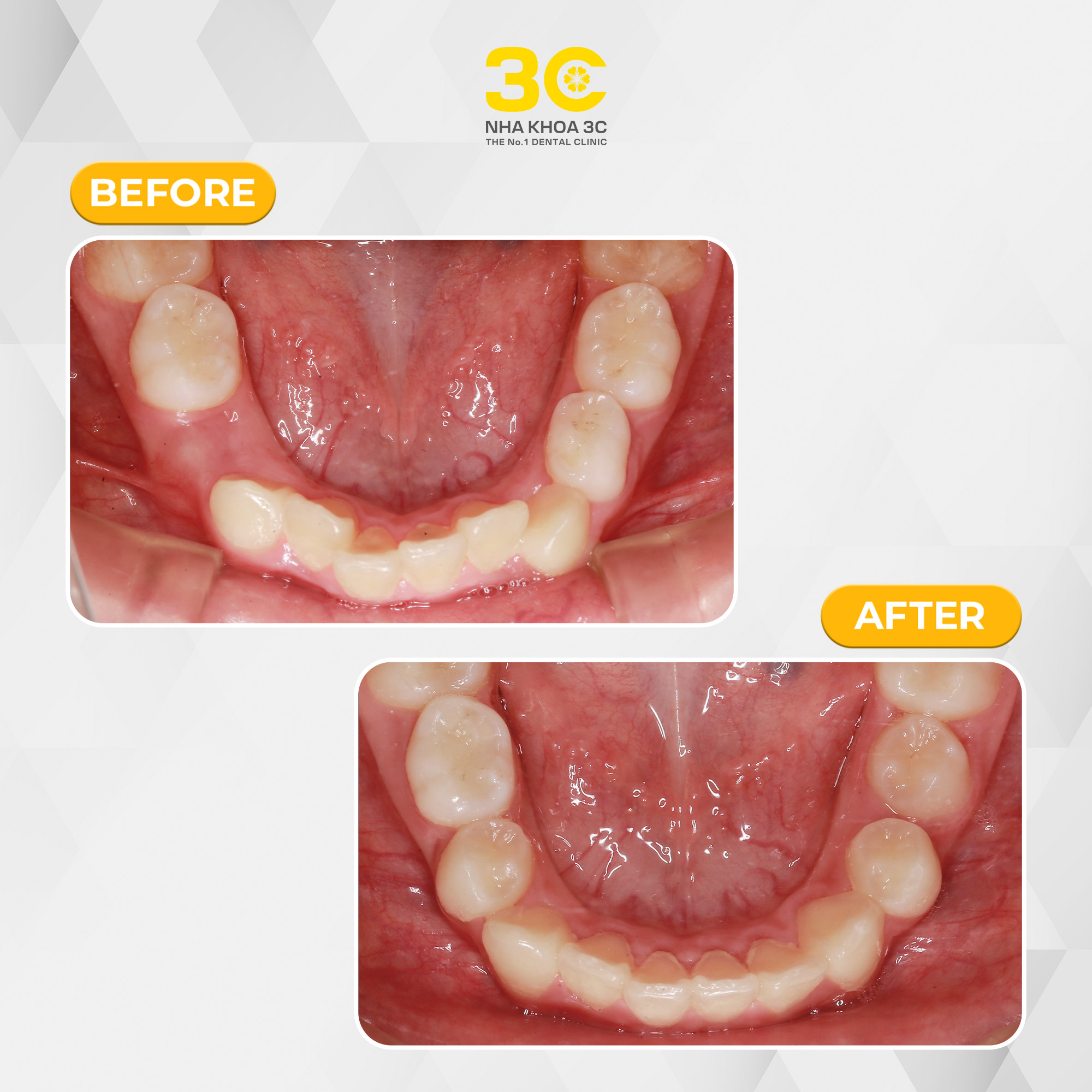 NHA KHOA 3C - DỊCH VỤ NHA KHOA UY TÍN TẠI TPHCM