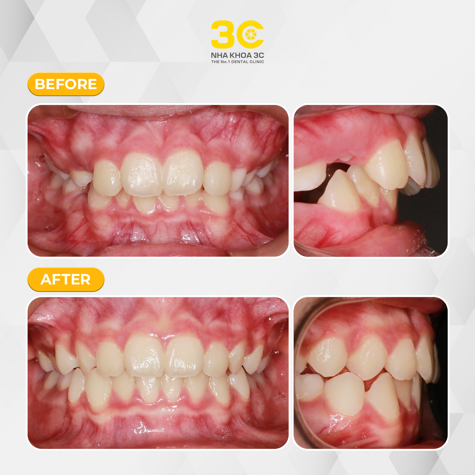 NHA KHOA 3C - DỊCH VỤ NHA KHOA UY TÍN TẠI TPHCM