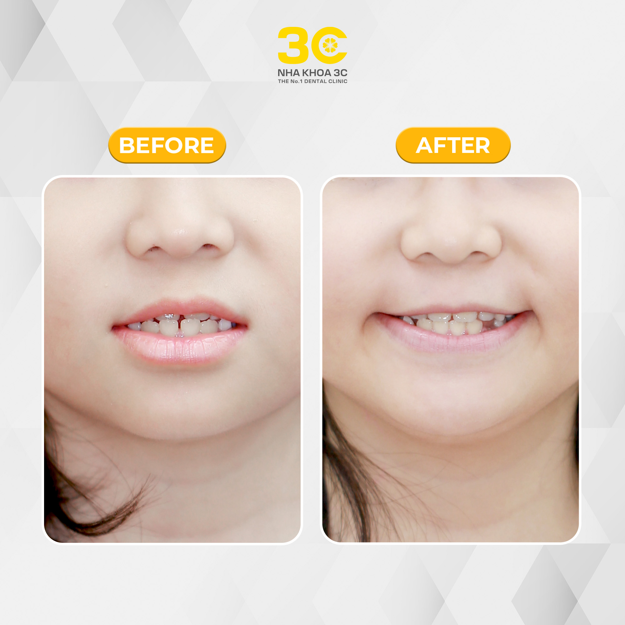 NHA KHOA 3C - DỊCH VỤ NHA KHOA UY TÍN TẠI TPHCM