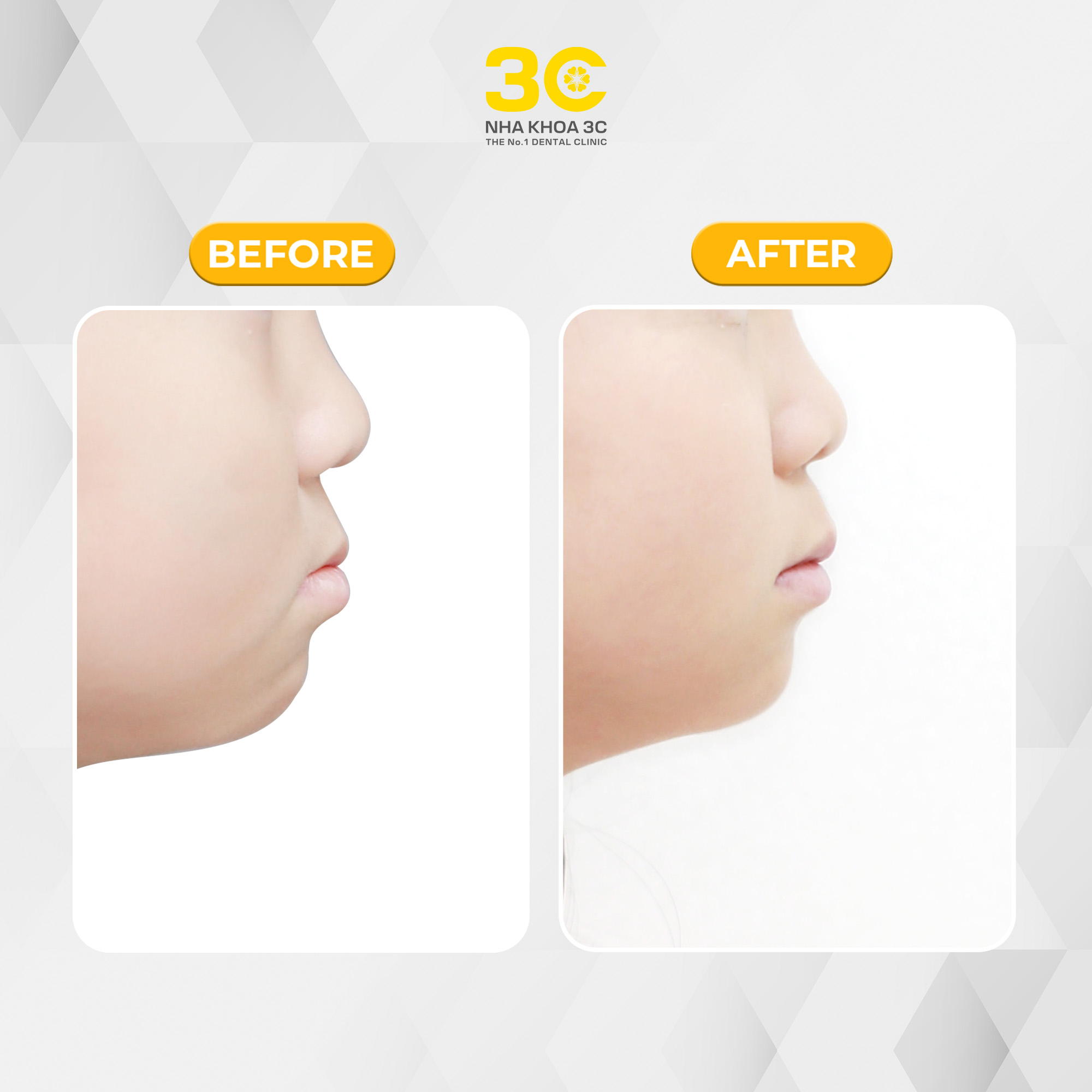 NHA KHOA 3C - DỊCH VỤ NHA KHOA UY TÍN TẠI TPHCM