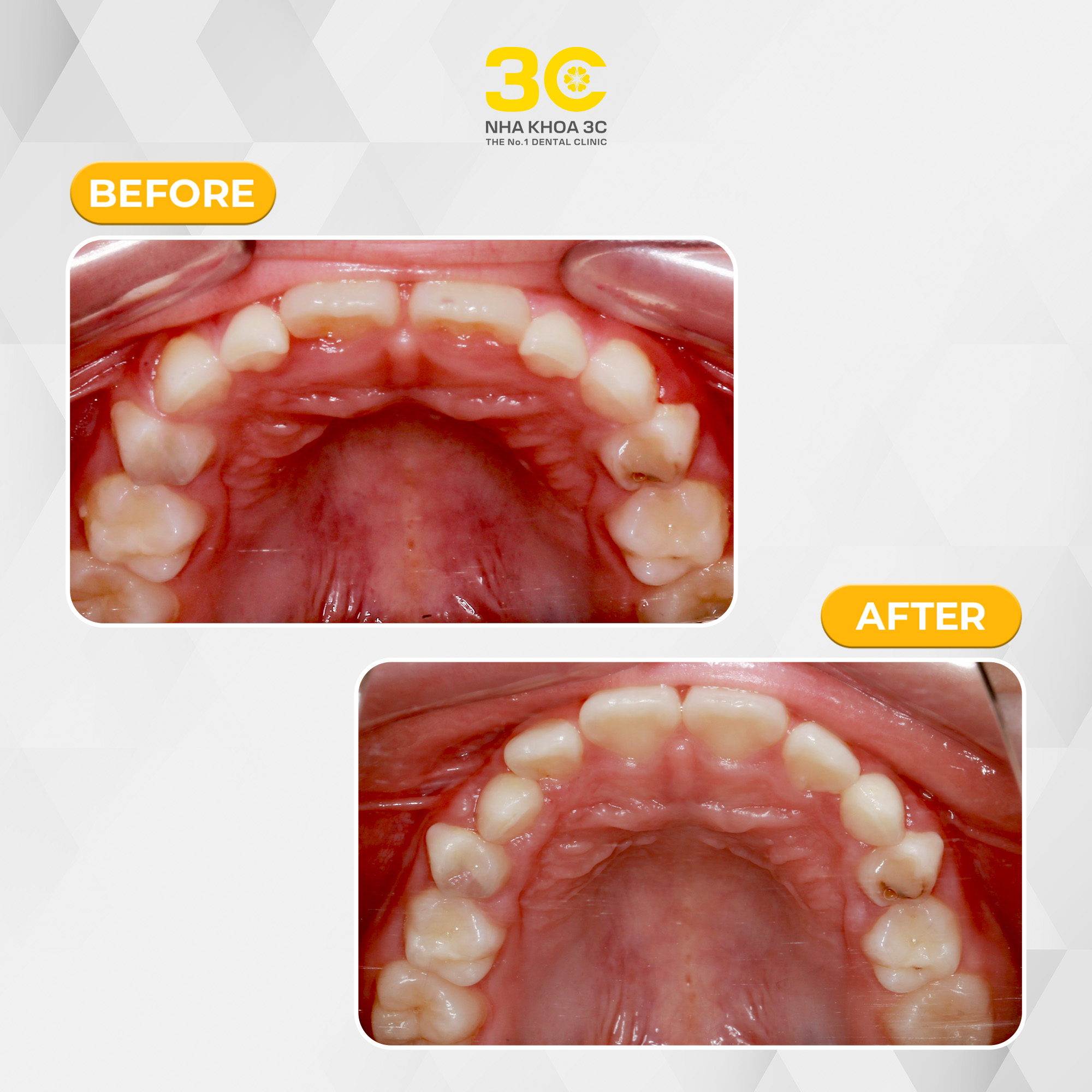 NHA KHOA 3C - DỊCH VỤ NHA KHOA UY TÍN TẠI TPHCM