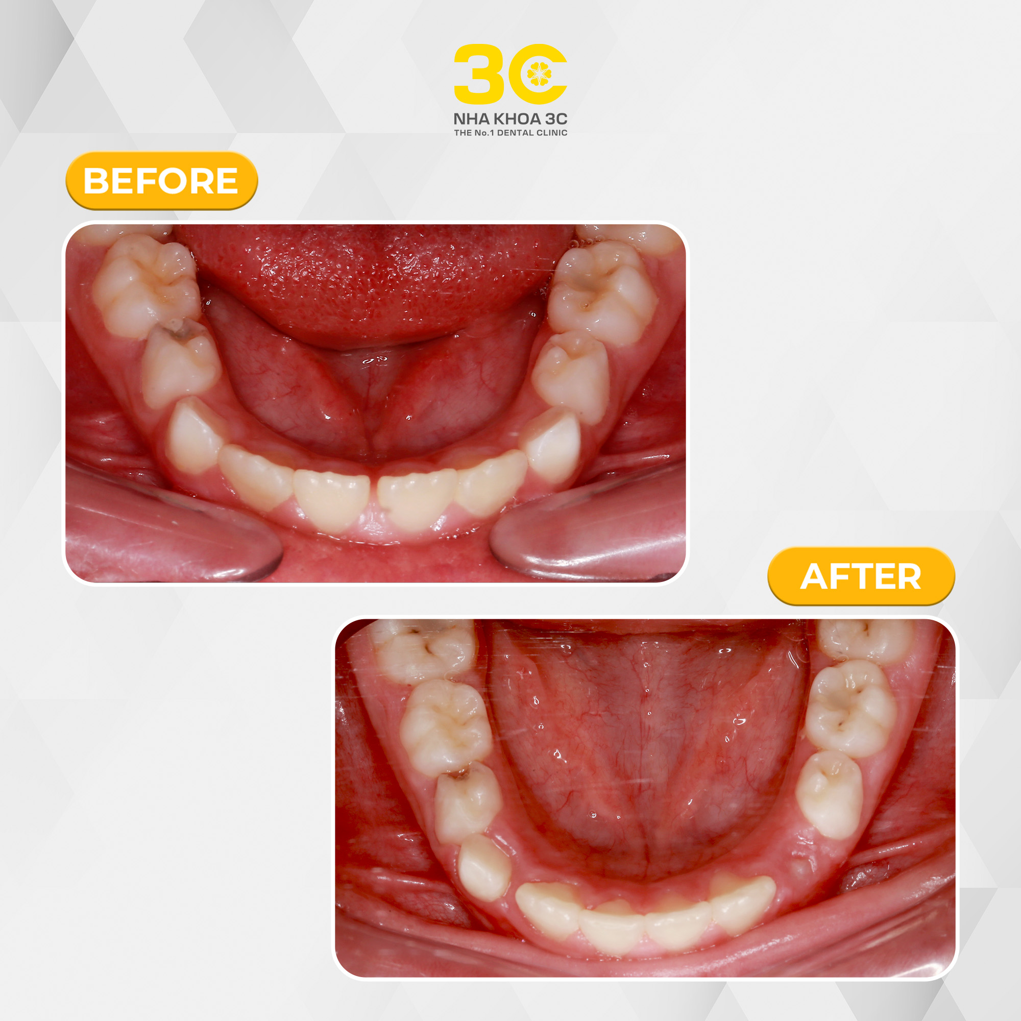 NHA KHOA 3C - DỊCH VỤ NHA KHOA UY TÍN TẠI TPHCM