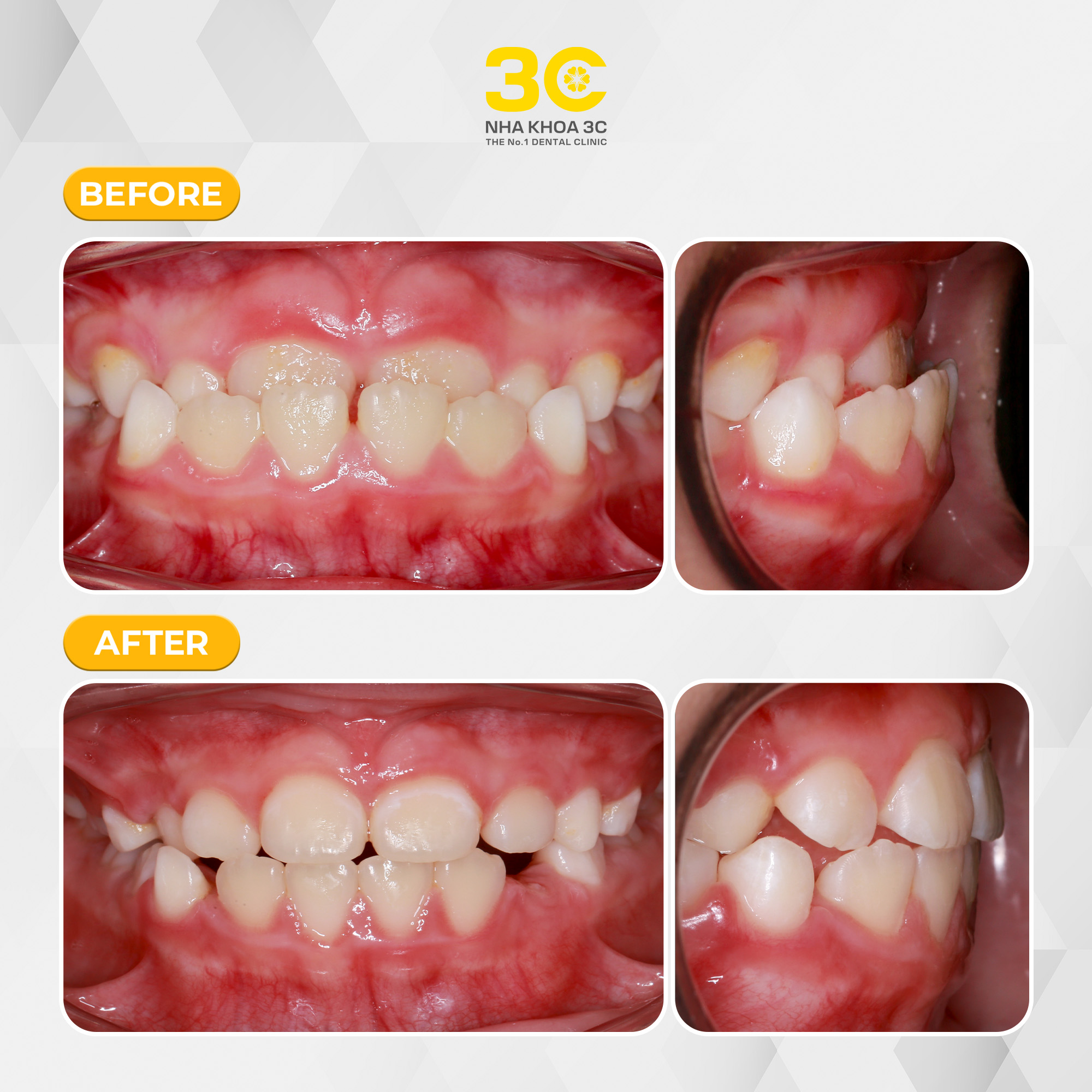 NHA KHOA 3C - DỊCH VỤ NHA KHOA UY TÍN TẠI TPHCM