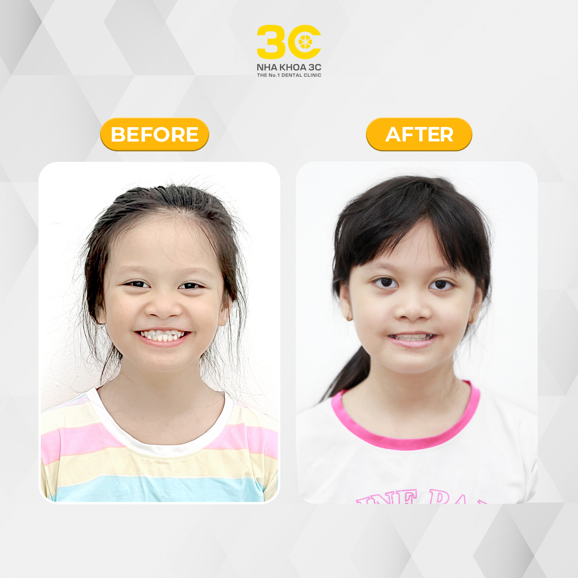 NHA KHOA 3C - DỊCH VỤ NHA KHOA UY TÍN TẠI TPHCM