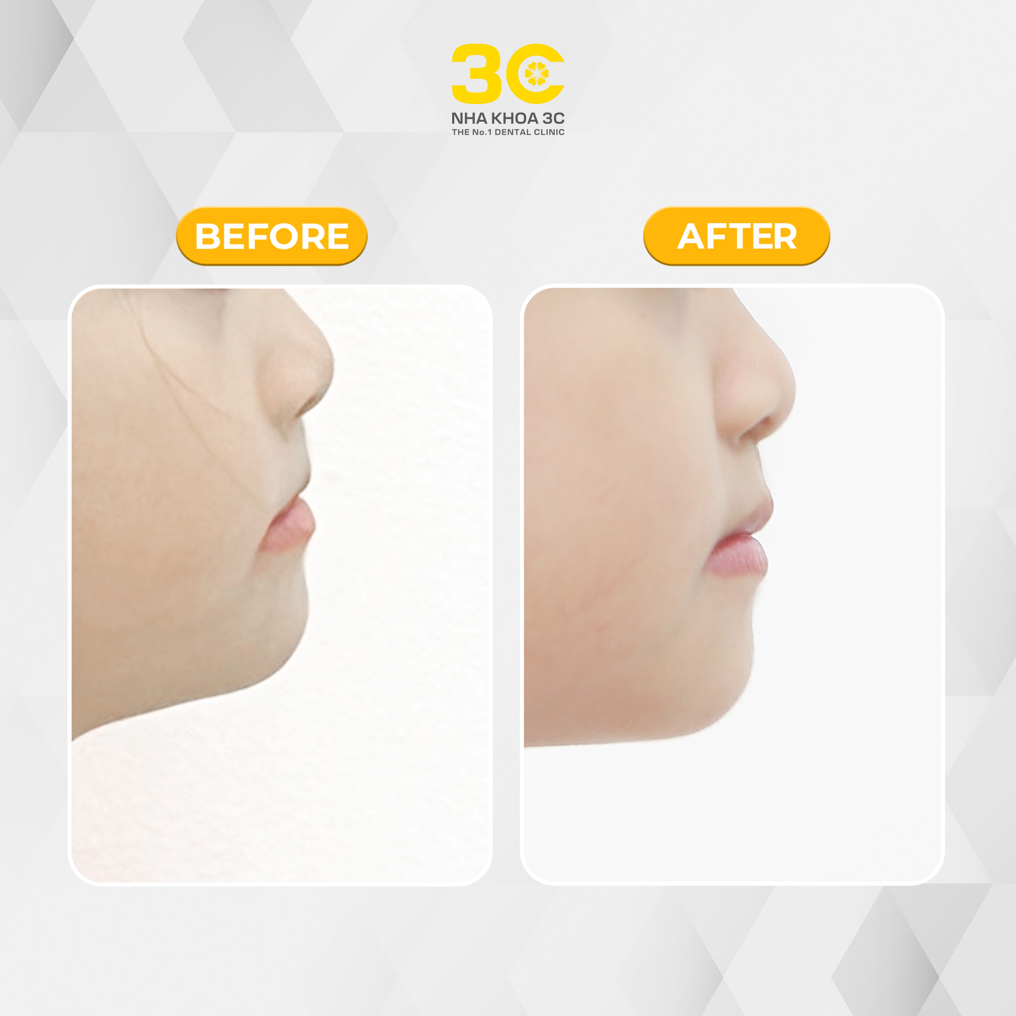 NHA KHOA 3C - DỊCH VỤ NHA KHOA UY TÍN TẠI TPHCM