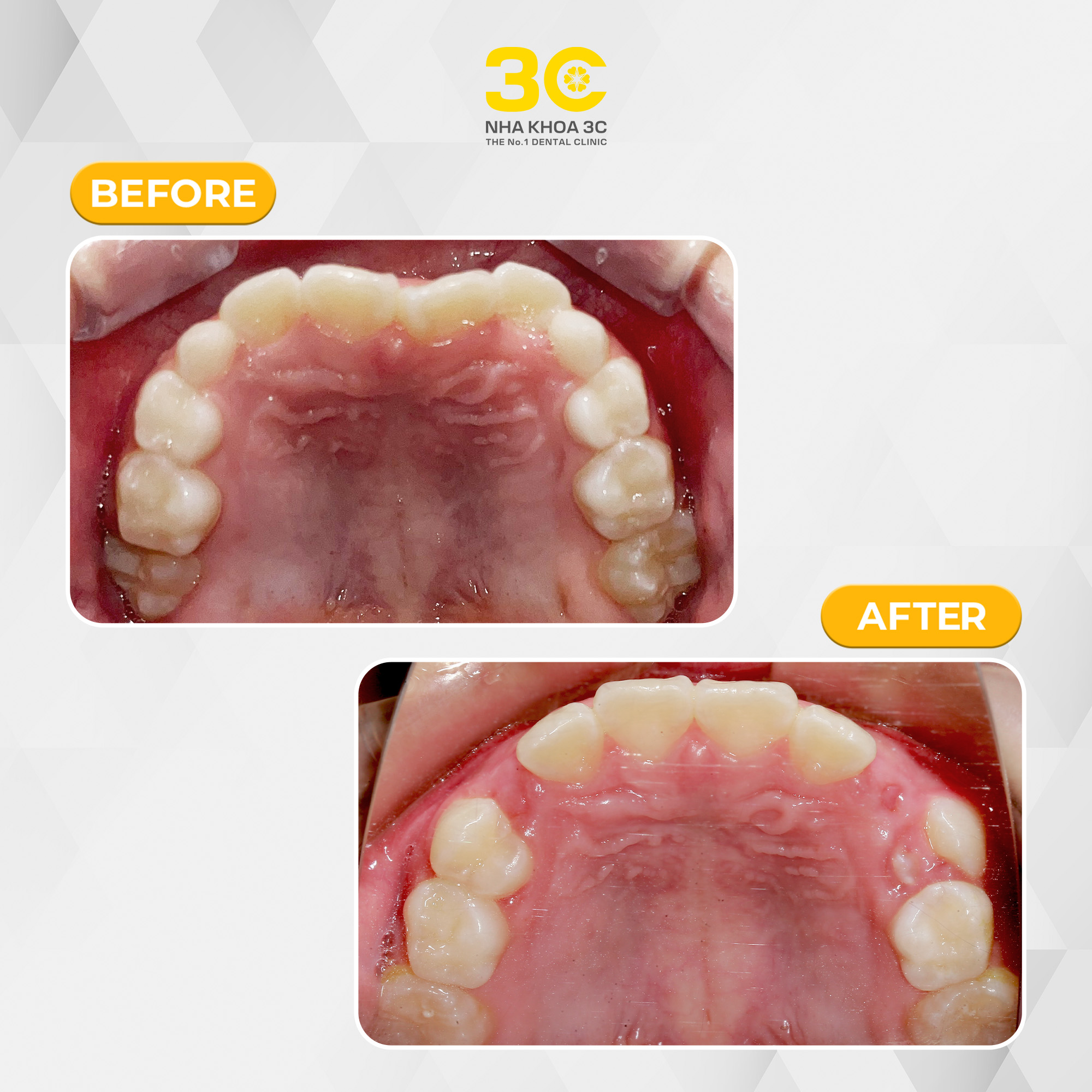 NHA KHOA 3C - DỊCH VỤ NHA KHOA UY TÍN TẠI TPHCM