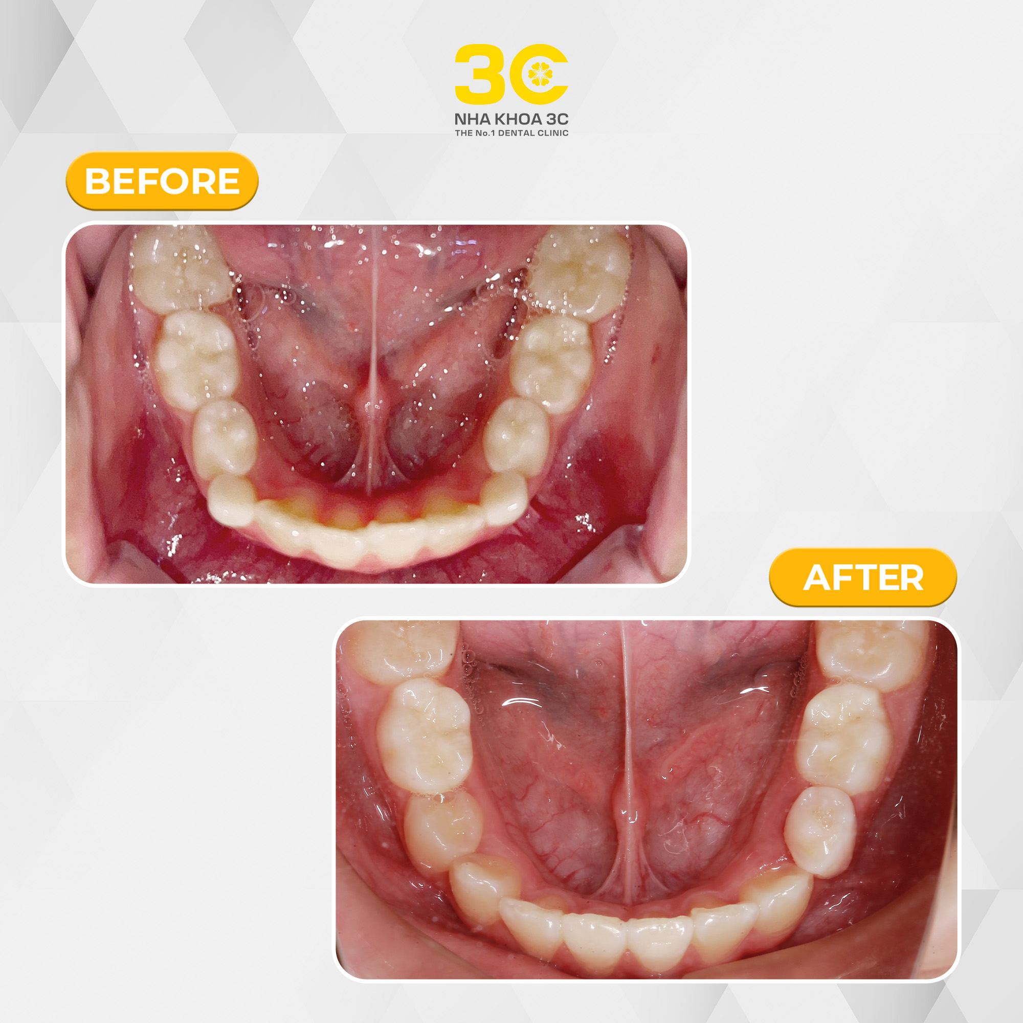 NHA KHOA 3C - DỊCH VỤ NHA KHOA UY TÍN TẠI TPHCM