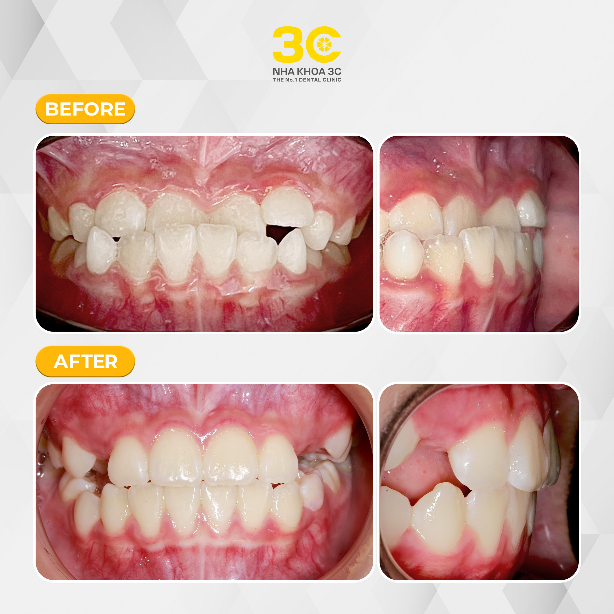 NHA KHOA 3C - DỊCH VỤ NHA KHOA UY TÍN TẠI TPHCM