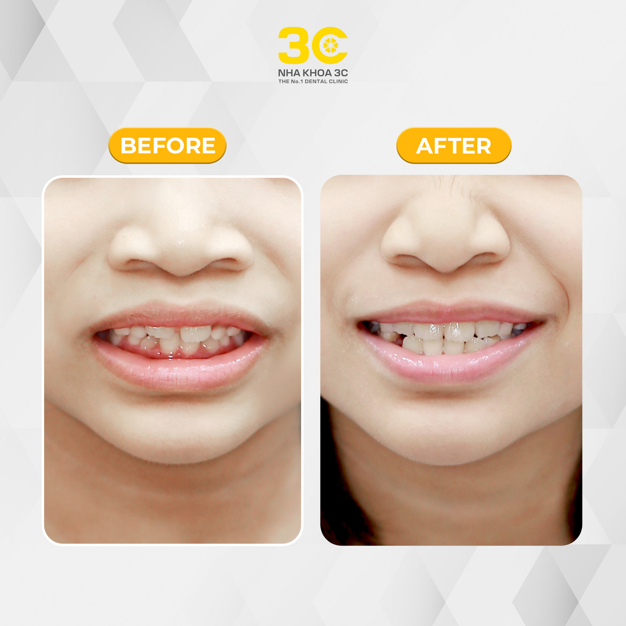 Mai Tran Bao Ngoc - Nha Khoa 3C