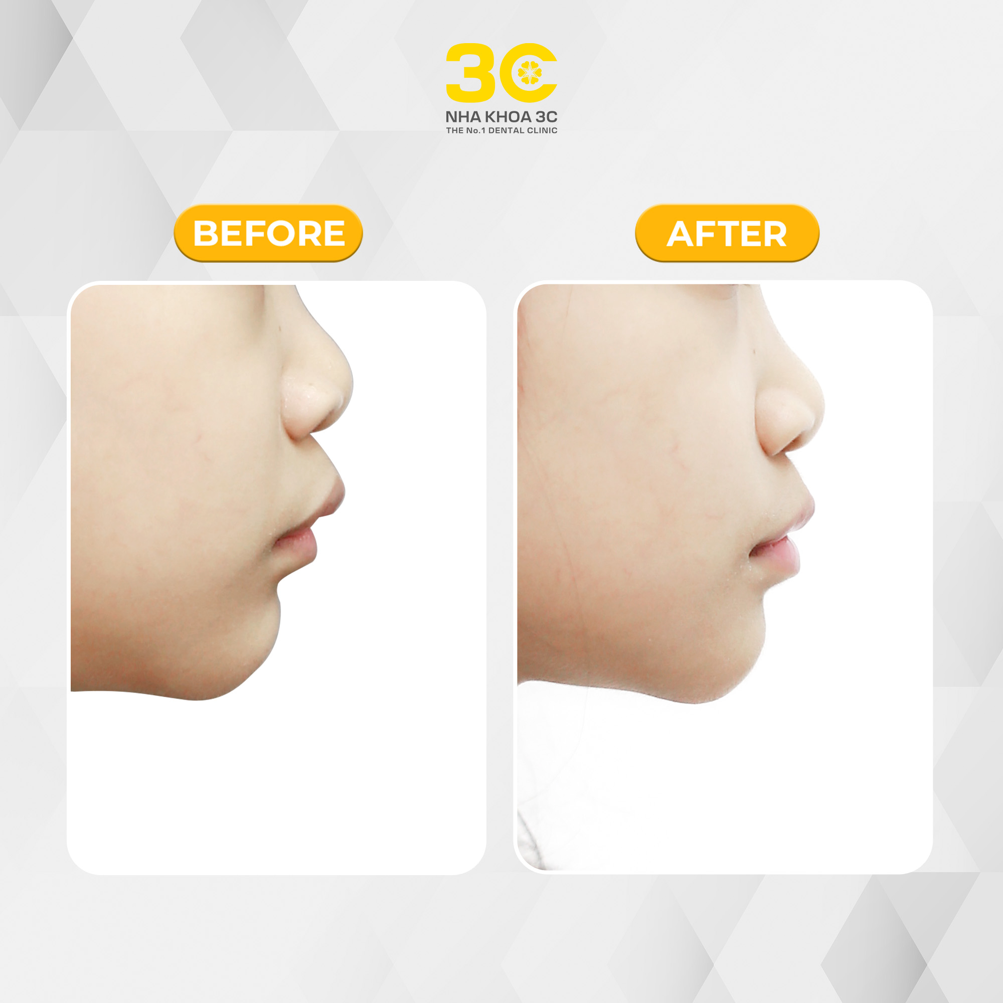 NHA KHOA 3C - DỊCH VỤ NHA KHOA UY TÍN TẠI TPHCM