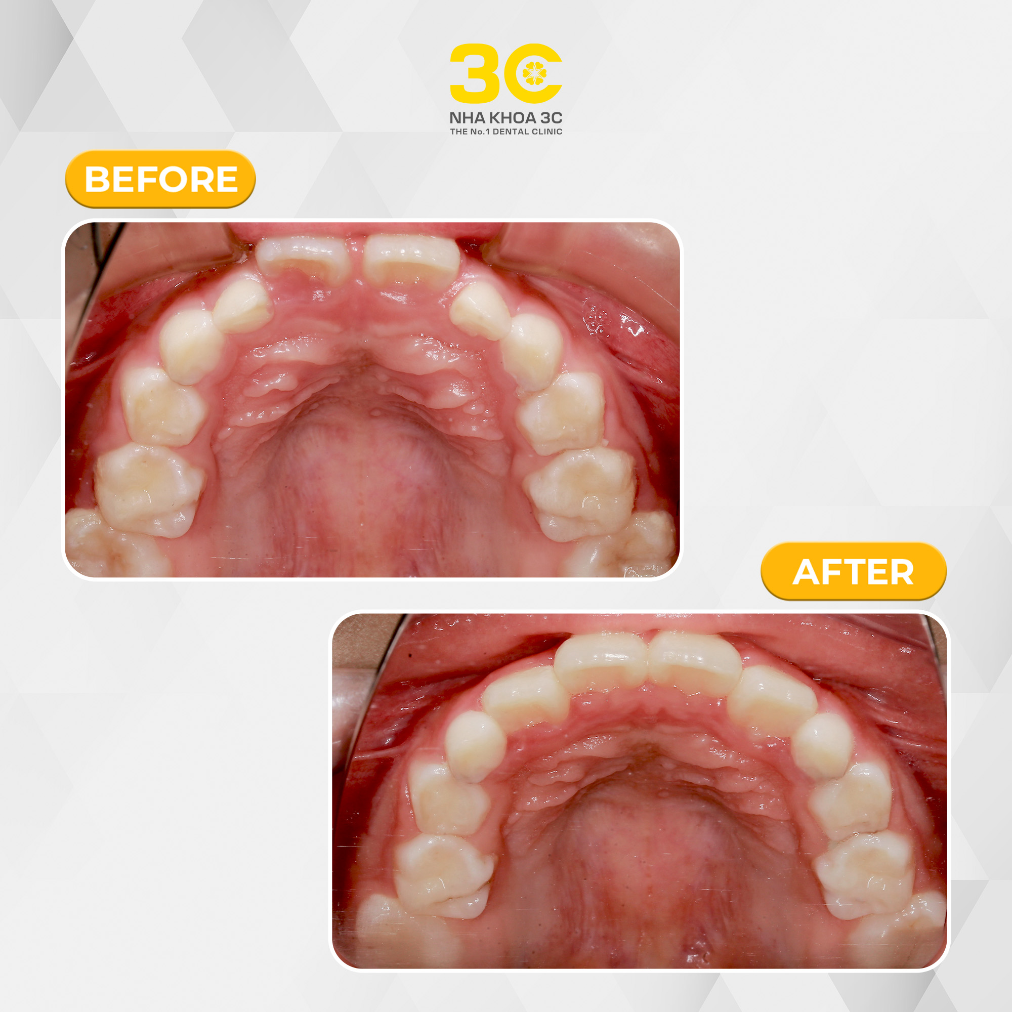 NHA KHOA 3C - DỊCH VỤ NHA KHOA UY TÍN TẠI TPHCM