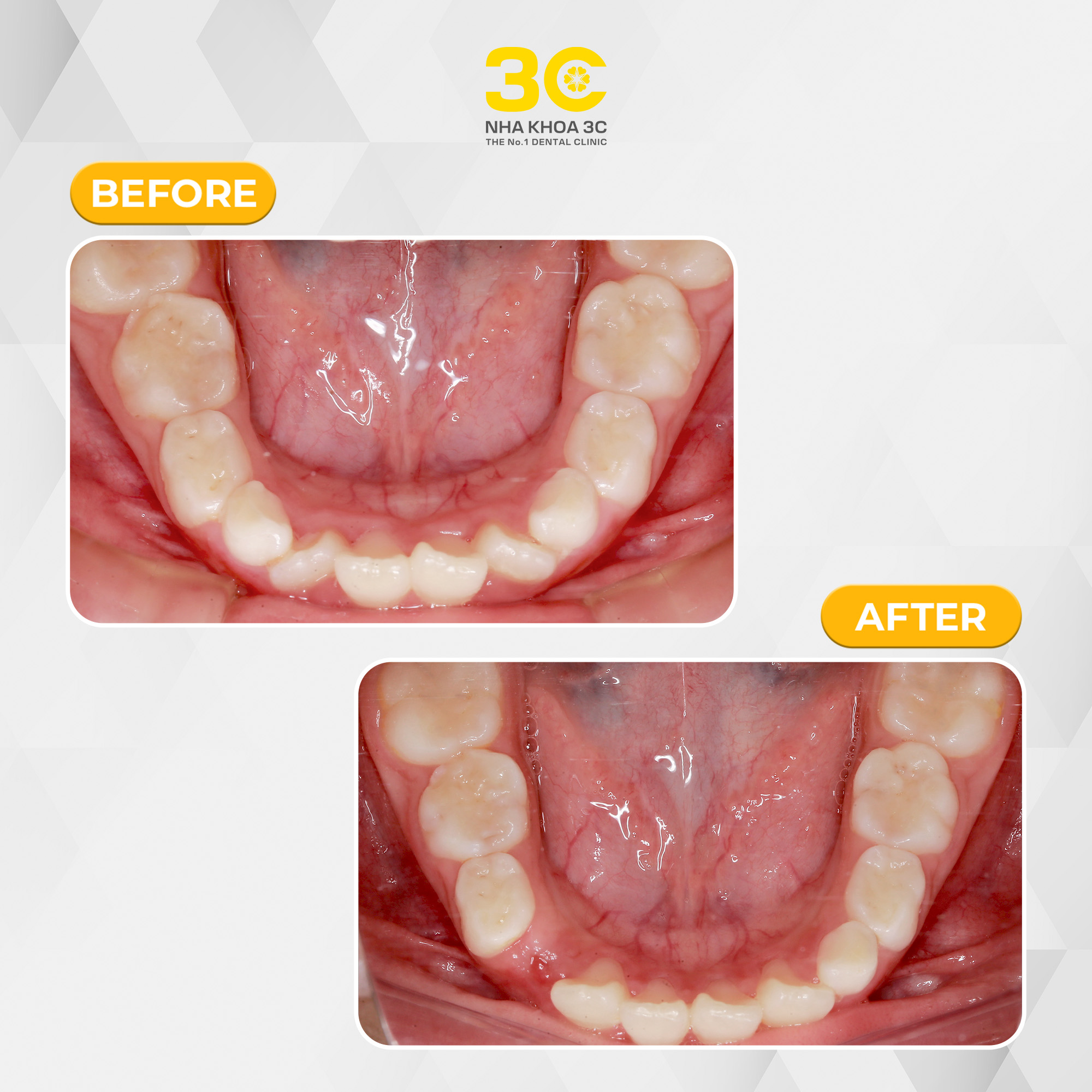 NHA KHOA 3C - DỊCH VỤ NHA KHOA UY TÍN TẠI TPHCM