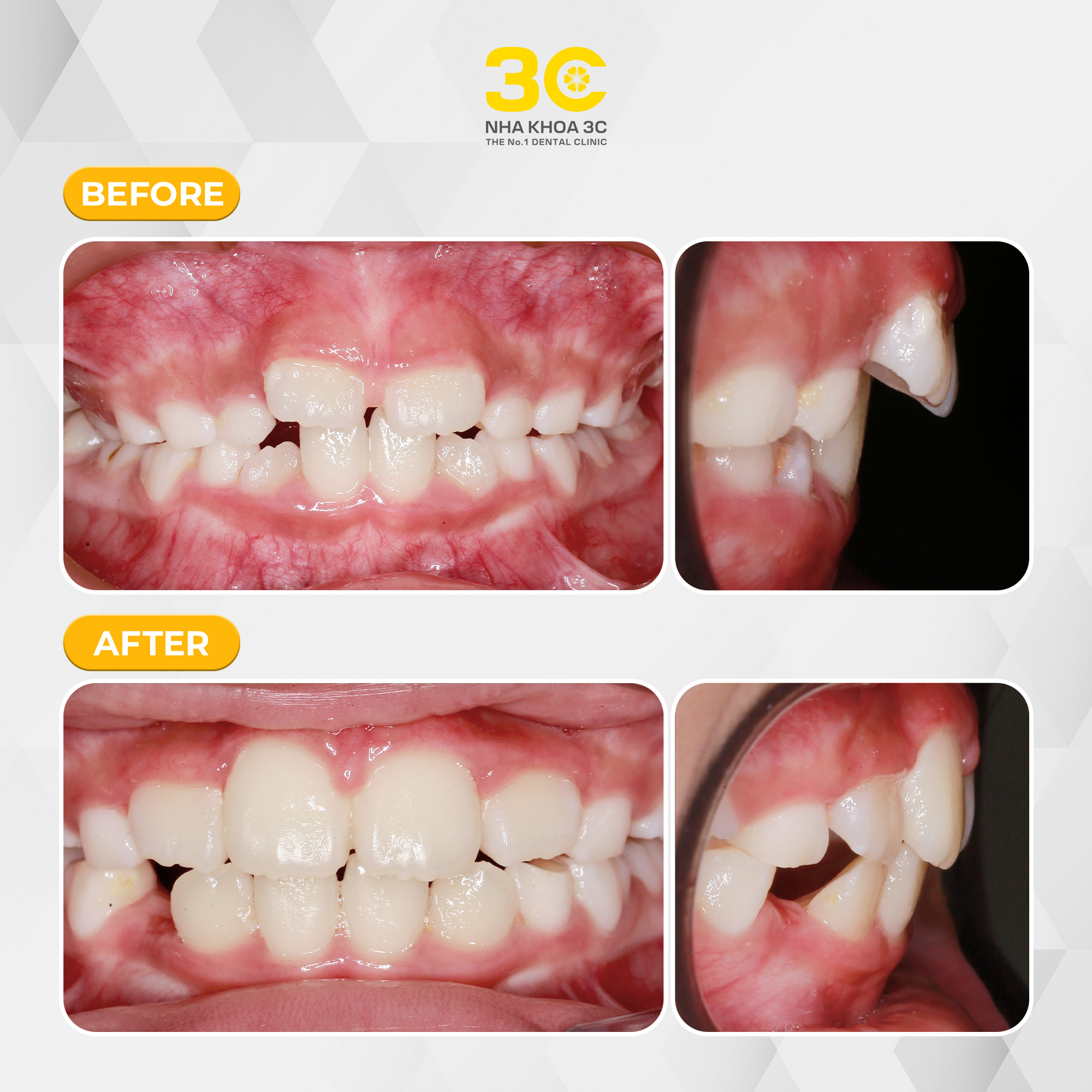 NHA KHOA 3C - DỊCH VỤ NHA KHOA UY TÍN TẠI TPHCM