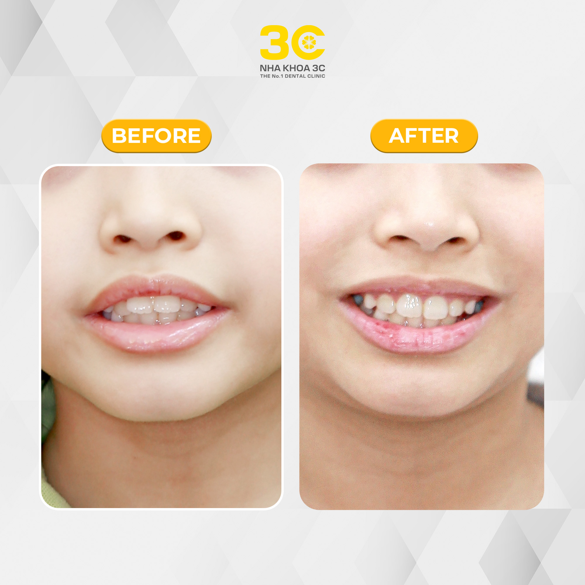 NHA KHOA 3C - DỊCH VỤ NHA KHOA UY TÍN TẠI TPHCM