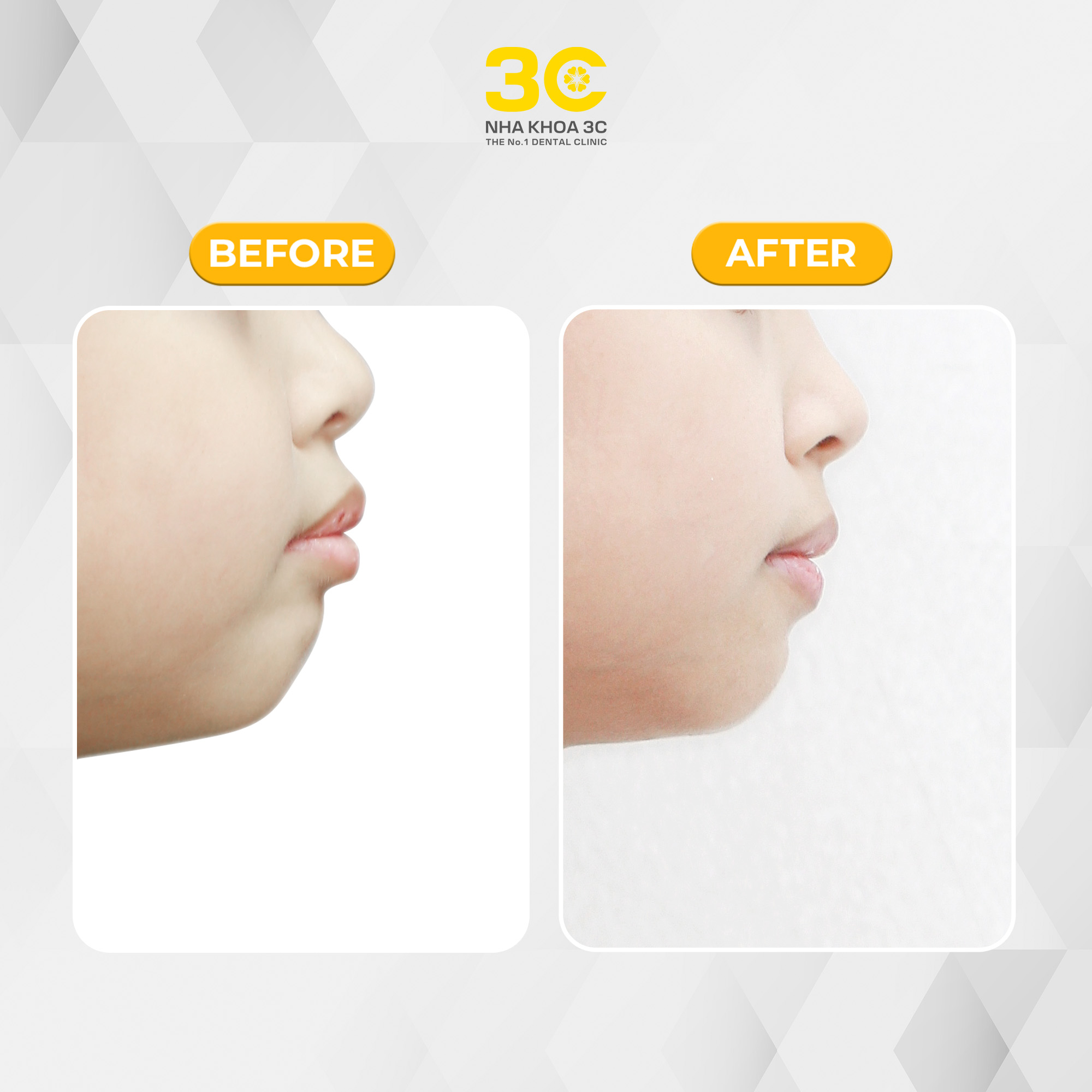 NHA KHOA 3C - DỊCH VỤ NHA KHOA UY TÍN TẠI TPHCM