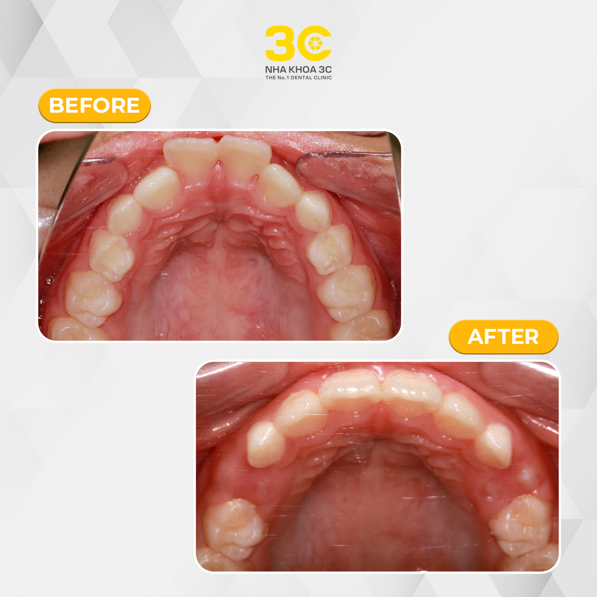 NHA KHOA 3C - DỊCH VỤ NHA KHOA UY TÍN TẠI TPHCM